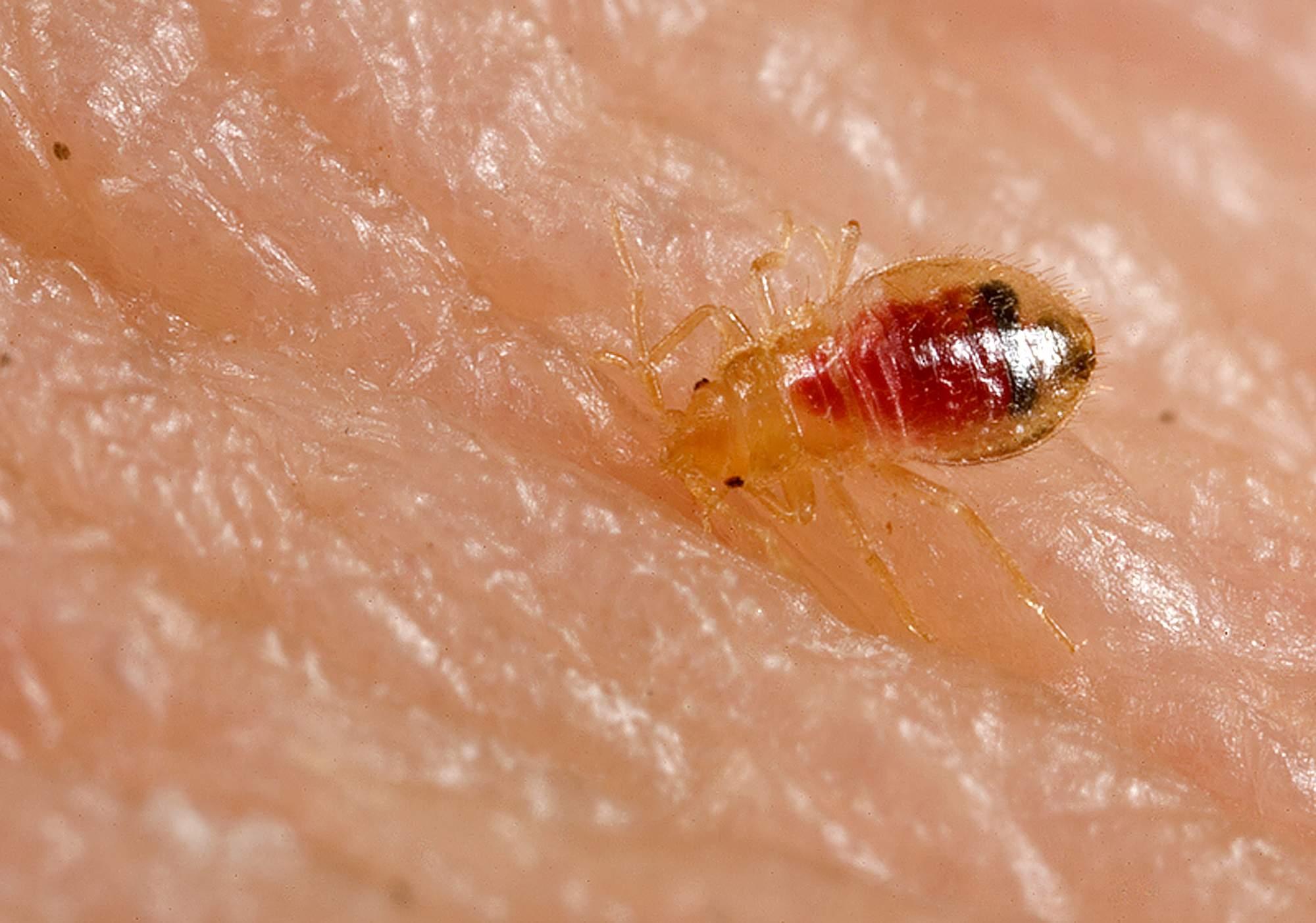 how to tell if a female bed bug is pregnant